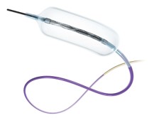 TransForm Occlusion Balloon Catheter - Fast, Easy, and Stable by Stryker